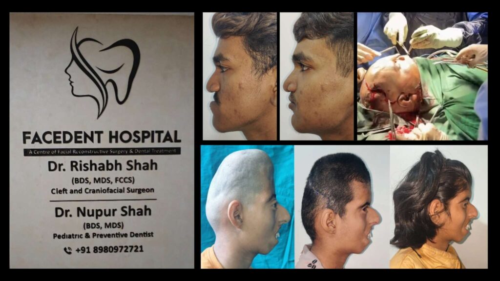 FaceDent dental hospital Ahmedabad with Dr Rishabh Shah and Dr Nupur Shah in consultation